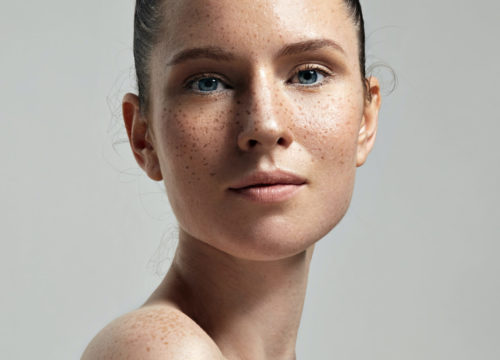 Woman with great skin after PlasmaMD skin rejuvenation treatments